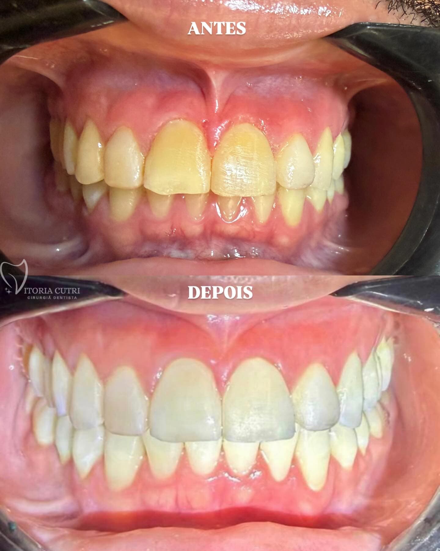 Dra. Vitória Cutri — Cirurgiã-Dentista